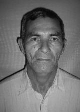 CHICO CABELUDO