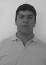 PEDRO BROCA