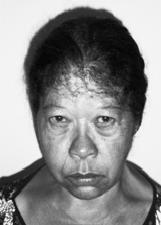 ZILDA MALAQUIAS