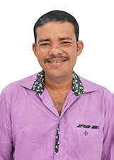 MARCIO PROTÉTICO