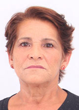 DIONE DO BAR
