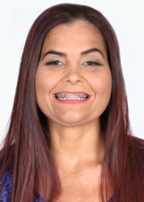 SIRLENE BATATA