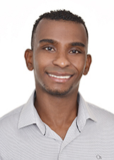 DOUGLAS PELÉ