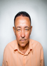 GILSON OLHO DE BALA
