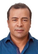 TONY SILVA