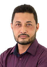 JOSE CASSIO OZORIO (PERNA)