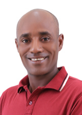 GILBERTO DA SANTA MARTA
