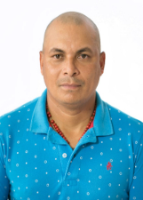 CHICO GEL