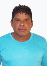 DÔDA