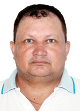 CESAR LAGOA