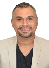 FESSÃO