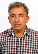 EDMILSON