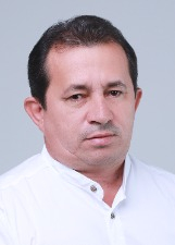 ZACARIAS DUARTE