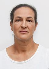 ALBA