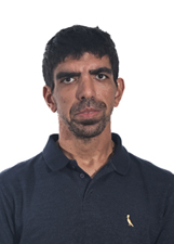 RENAN HOMI